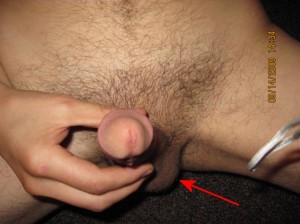 Case_Study_01_Commentary_06-OnlyLeftTesticleVisible