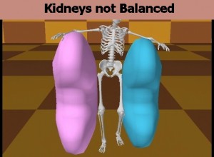 Homosexual_Lopsided_Body-KidneysNotBalanced