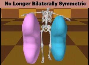 Homosexual_Lopsided_Body-KidneysNotBilaterallySymmetric