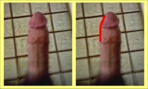 The_Straight_Pointing_Penis_Analysis_10-PenisShapeChanges